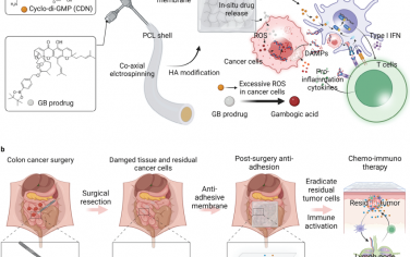 Adv. Mater：STING膜可预防结直肠癌的术后组织粘连和肿瘤复发