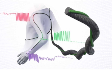 Science Advances：用于智能服装的光纤分布式传感